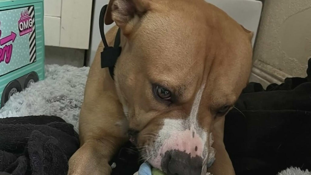 Teen girl remains hospitalized after dog attack in northwest Miami-Dade; owner surrenders pit bull — CBS Miami, Pinecrest Health news