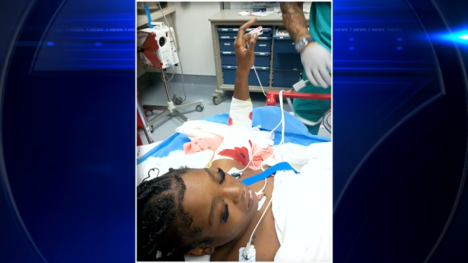 17-year-old speaks out while recovering from serious injuries in pit bull attack in NW Miami-Dade — WSVN 7 Miami-Dade, Pinecrest Health news